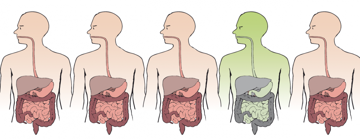 Memanipulasi mikrobioma usus: potensi kotoran